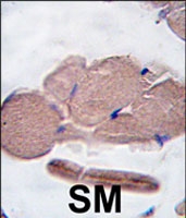PAB3887 - Myostatin