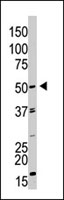 PAB3888 - GDF9