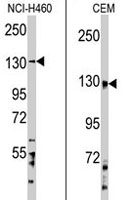 PAB3891 - UBE4A