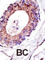 PAB3892 - UBE2D1 / SFT