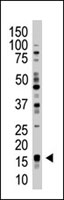 PAB3893 - UBE2L3 / UBCH7