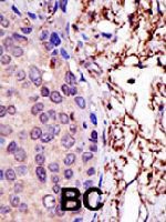 PAB3893 - UBE2L3 / UBCH7