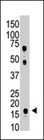 PAB3896 - UBE2L6 / RIG-B