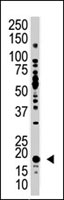 PAB3897 - UBE2G1