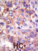 PAB3897 - UBE2G1