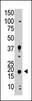 PAB3900 - UBE2G2