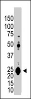 PAB3903 - UCHL1 / PGP9.5