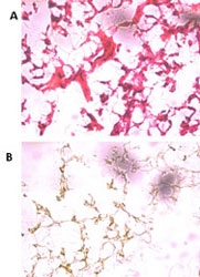 PAB3907 - UCHL5