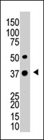 PAB3907 - UCHL5