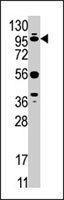 PAB3912 - USP1