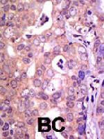 PAB3912 - USP1