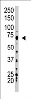 PAB3913 - USP2