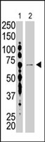 PAB3914 - USP2