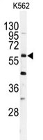 PAB3915 - USP2