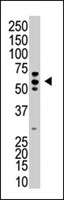 PAB3918 - USP3