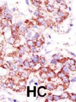 PAB3920 - USP4 / UNP