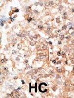 PAB3924 - Osteocalcin