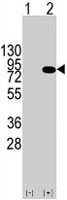 PAB3931 - PIK3R1 / GRB1