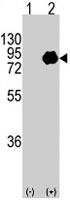 PAB3933 - PIK3R2