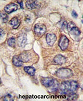 PAB3935 - CD140a / PDGFRA