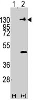 PAB3935 - CD140a / PDGFRA