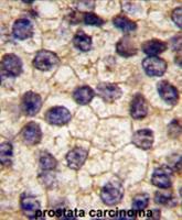 PAB3936 - CD140a / PDGFRA