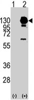 PAB3936 - CD140a / PDGFRA