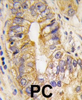 PAB3938 - CD140a / PDGFRA
