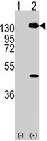 PAB3938 - CD140a / PDGFRA