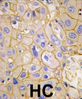 PAB3940 - CD140a / PDGFRA