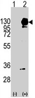 PAB3940 - CD140a / PDGFRA
