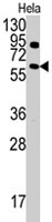 PAB3943 - Anthrax toxin receptor 1 / ANTXR1