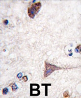 PAB3946 - B-Raf proto-oncogene