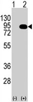 PAB3946 - B-Raf proto-oncogene