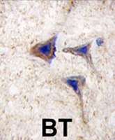 PAB3947 - B-Raf proto-oncogene