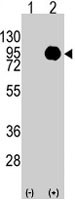 PAB3947 - B-Raf proto-oncogene