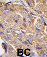 PAB3951 - EIF4B