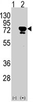 PAB3951 - EIF4B