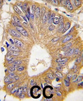 PAB3954 - EIF4EBP1 / 4E-BP1