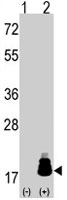 PAB3954 - EIF4EBP1 / 4E-BP1