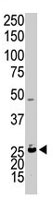 PAB3988 - Adenylate kinase 4 / AK4