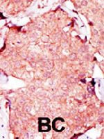PAB3988 - Adenylate kinase 4 / AK4