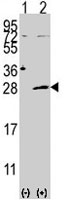 PAB3988 - Adenylate kinase 4 / AK4