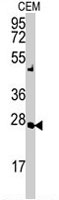 PAB3993 - Adenylate kinase 2 / AK2