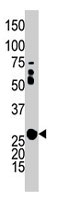 PAB3993 - Adenylate kinase 2 / AK2