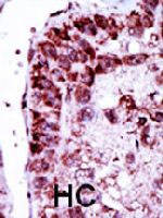 PAB3993 - Adenylate kinase 2 / AK2