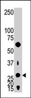 PAB3994 - Adenylate kinase 2 / AK2