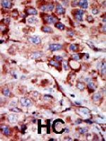PAB3994 - Adenylate kinase 2 / AK2