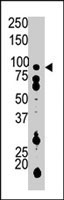 PAB3996 - PFKP