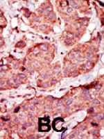 PAB3996 - PFKP